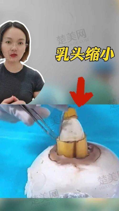 三、广州医 科 大学附属第一医院——整形外科
