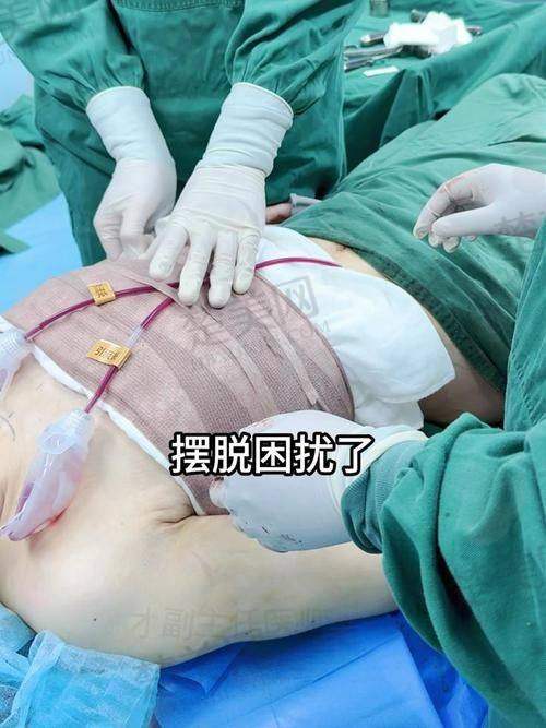 四、广东省人民医院——血管与整形外科