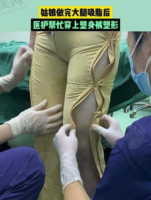 七、关于成都李辉医生做唇怎么样的探讨