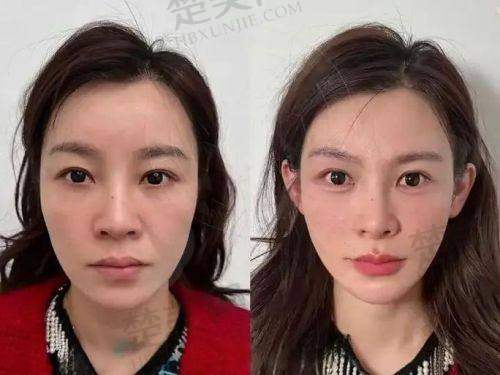 七、白春燕医生真实的患者评价