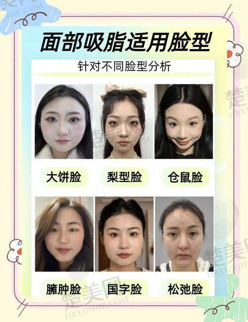 三、王棚医生技术怎么样？