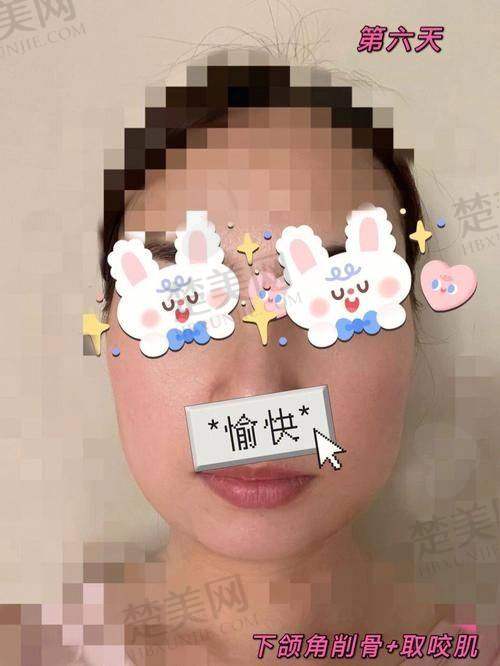 温馨提示：安心手术有保护