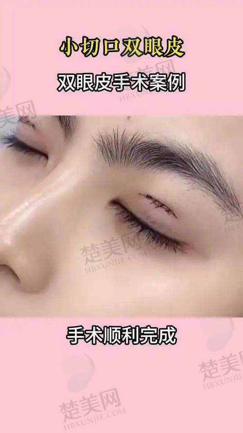 九、排名第八：武汉涵美冯晓玲医生