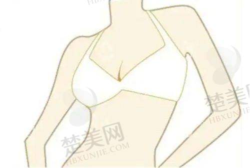 一、广州美莱医疗美容医院：综合实力强劲的连锁医美