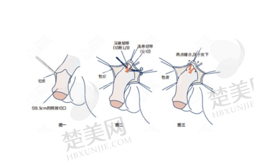 二、北京八大处郭鑫医生技术实力靠谱吗