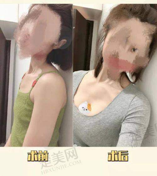 2. 宜昌王女士