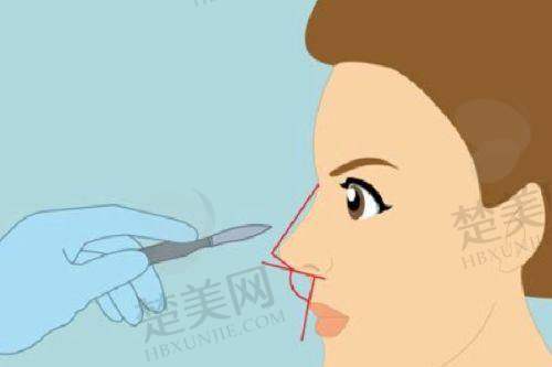 二、东莞紫芯医疗美容门诊部怎么样？
