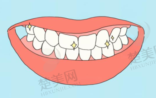 五、重庆河马口腔——当天种牙当天啃排骨
