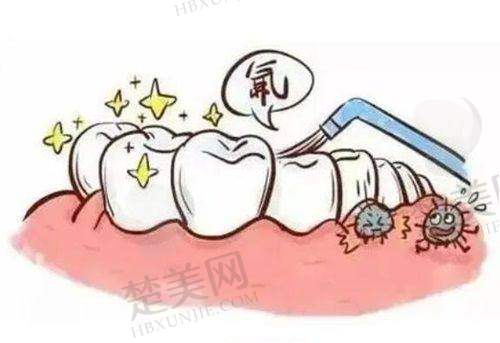 五、淮安诺贝尔口腔医院的收费情况