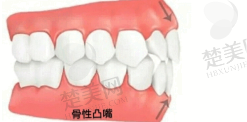 五、北京爵冠口腔靠谱么?透明消费让人放心