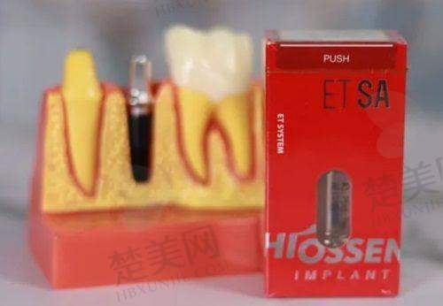 四、北京爵冠口腔靠谱么?用户真实口碑良好