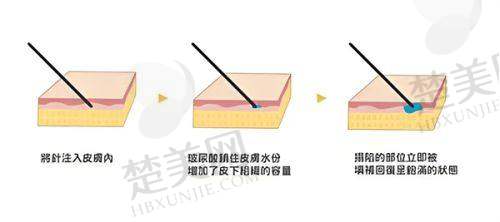 五、北京八大处郭鑫医生开眼角攻略之价格分析