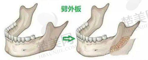 五、总结