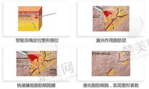 八、杭州蜜多盈盈医疗美容诊所预约方式
