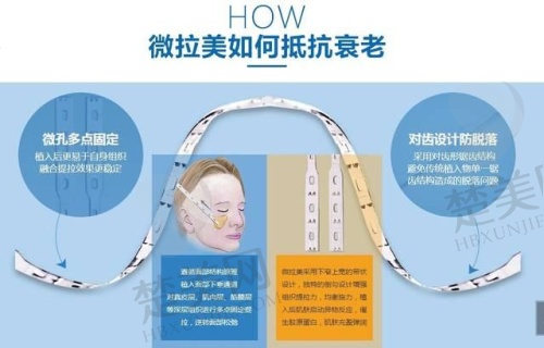 三、广州禾丽整形医院价格参考