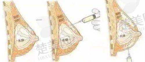四、银川维多利亚医疗美容医院：专精化定制化的医美服务
