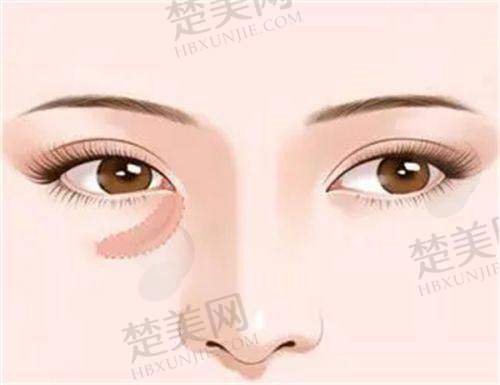 一、重庆涪陵和美妇产医院医疗美容科正规吗？
