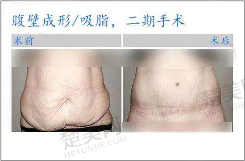 二、美容医院特色大揭秘