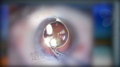 2025北京同仁医院眼科排名前五医生详细介绍