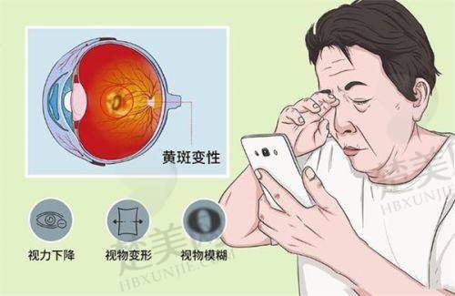 合肥沃瑞眼科医院好不好？正规资质、精良团队与先进设备，打造高品质近视治疗体验！