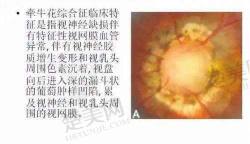 二、合肥普瑞眼科医院线上预约全攻略