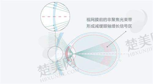 二、南昌华厦眼科医院靠谱吗——医疗资质与技术实力