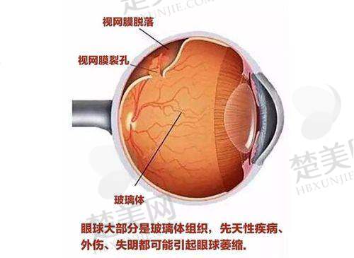 六、温州华厦眼科医疗团队优势