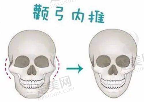 三、重庆涪陵和美妇产医院医疗美容科诊疗项目有哪些？