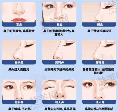九、深圳韩秀医疗美容门诊部真实的患者评价