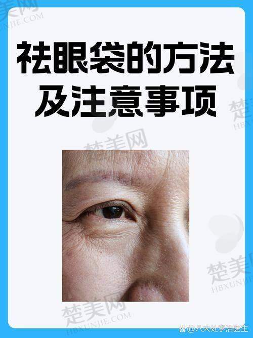 五、上海美诗沁祛眼袋主推医生——宣瑞军