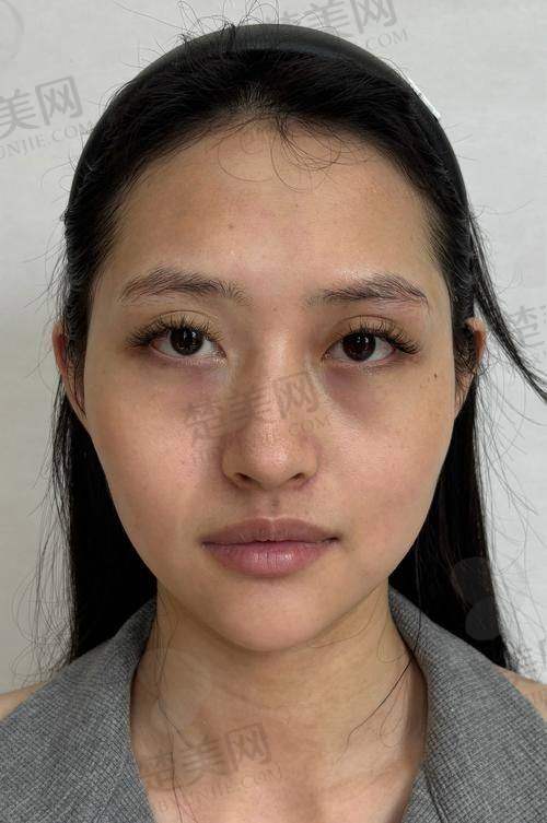 一、成都杨迪医生简介