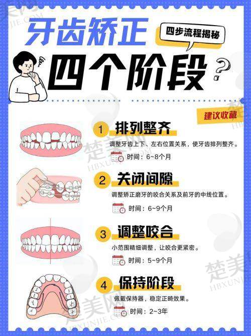 二、常见矫正方式及费用范围