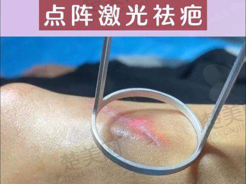 二、福州玛恩皮肤疤痕修复基地怎么样？