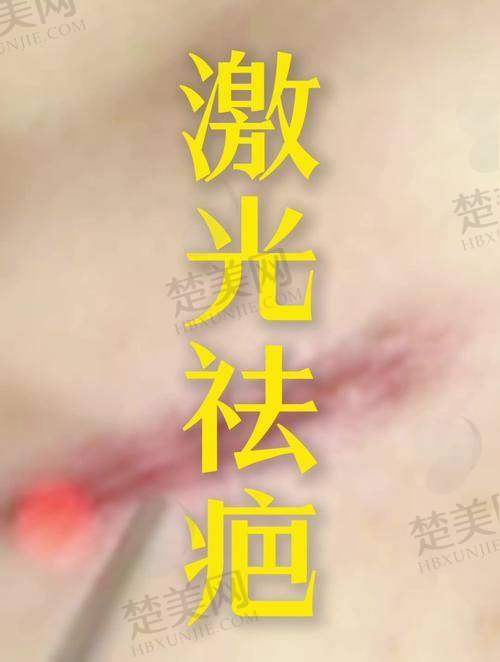 九、福州玛恩皮肤疤痕修复基地真实的患者评价