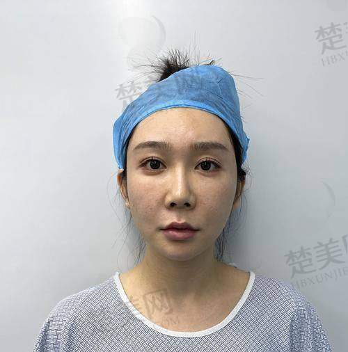 一、成都王皓民人中四项套餐价格详情