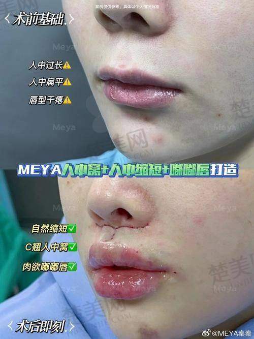 温馨提示：选对医院医生，做好术后护理