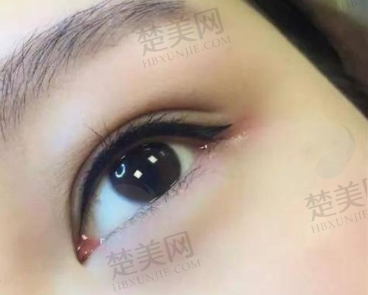 二、重庆涪陵和美妇产医院医疗美容科怎么样？