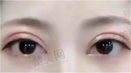 三、鞍山燕丽医疗美容医院诊疗项目有哪些？