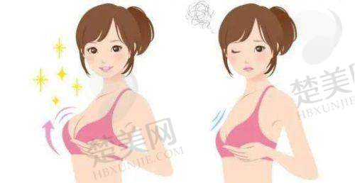 五、林沸腾医生隆胸技术的临床应用与实例
