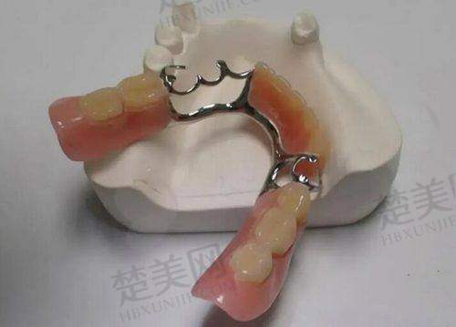 七、珠海六和口腔医院怎么样