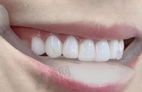 一、深圳福华口腔医院简介