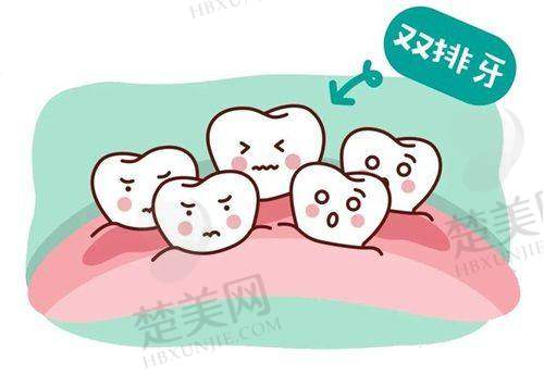 二、葫芦岛兴城市米奇口腔：专精治疗与合理收费的典范