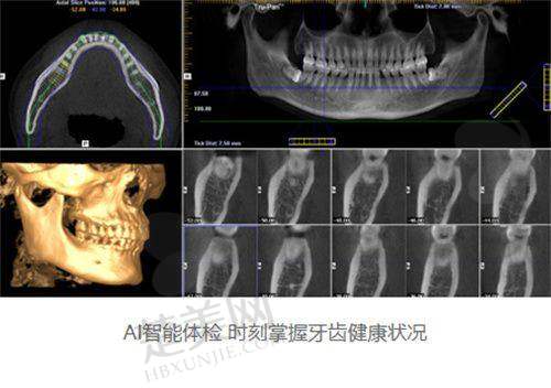 五、淮安诺贝尔口腔：高品质品牌保护