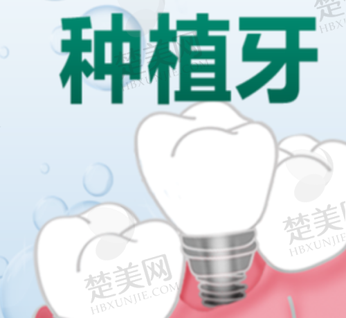 七、南京弗莱堡种植牙：穿颧种植牙价格及替代方案