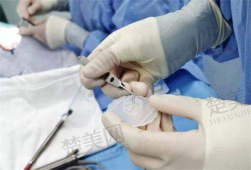 四、绵阳富临眼科医院医生：经验多实力强