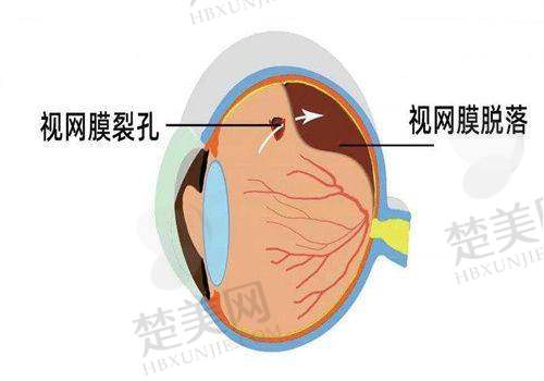 二、绵阳富临眼科医院：科室项目全解析