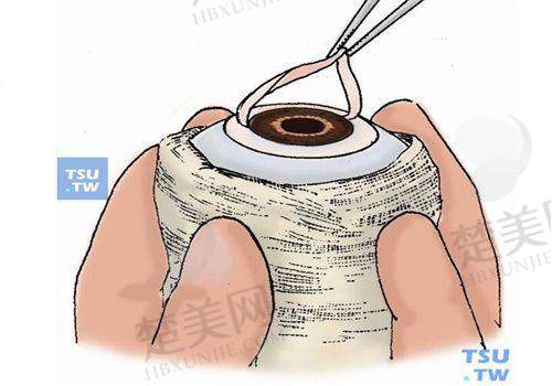 一、成都普瑞眼科医院做近视手术怎么样之医院综合实力