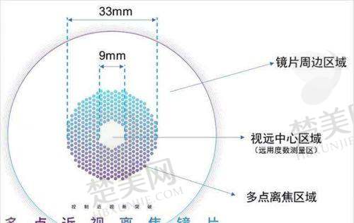 毕节阳明眼科医院是公立医院吗?正规私立二级眼科,技术优、环境好、价格合理!