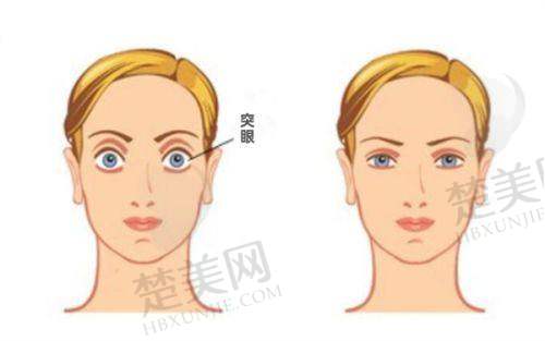 三、广州视可佳眼科门诊部诊疗项目有哪些？