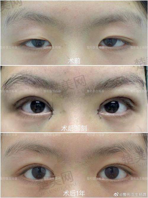 七、东莞台心李韵芳医生：细节至上成就自然健康美